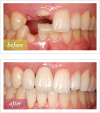 see our smile gallery »